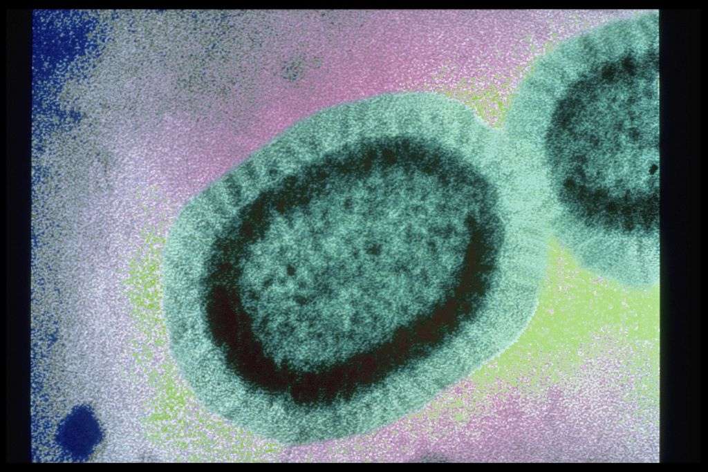 L'un des virus de la grippe, vu ici sous microscopie électronique, mute très régulièrement. Or, le variant à l'origine de l'épidémie de grippe A de ces dernières années est très pathogène mais ne se transmet pas entre êtres humains. Pour éviter de rester impuissants face à une mutation naturelle qui le rendrait très contagieux, les biologistes cherchent à mieux cerner notre potentiel ennemi. © Sanofi Pasteur, Flickr, cc by nc nd 2.0