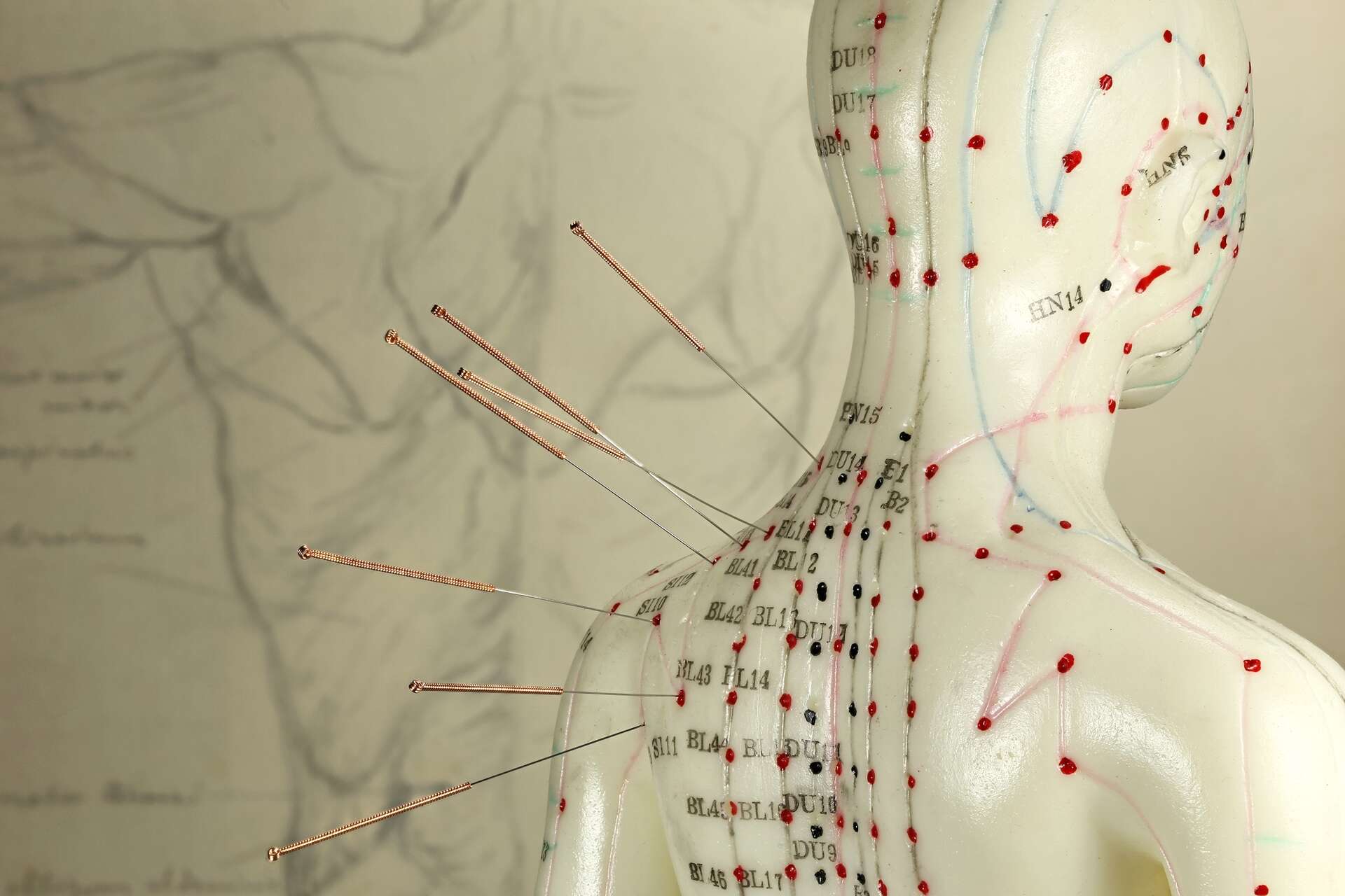Trouver un acupuncteur sérieux