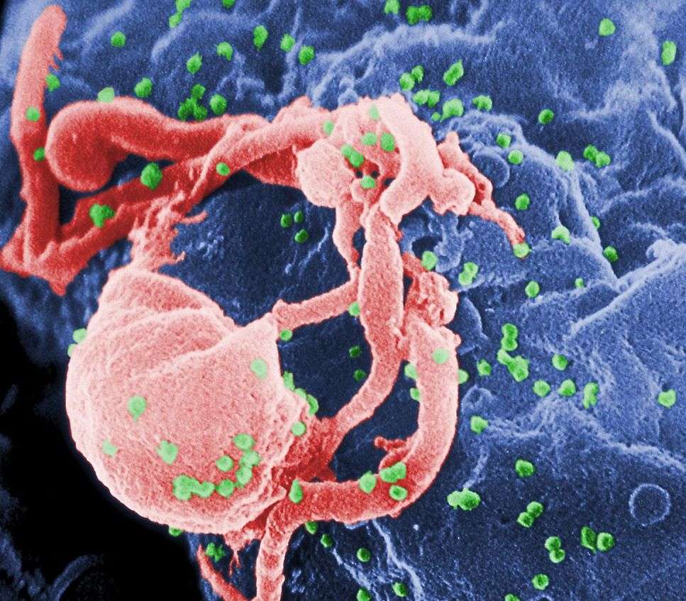 Le VIH, ici en vert, est un tueur en série miniature qui a déjà emporté des millions de vies, et qui malheureusement poursuivra encore son œuvre meurtrière. Quand pourra-t-on stopper le Sida ? © Goldsmith et al., CDC, DP