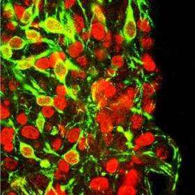 Les cellules souches sont aussi un espoir de traitement de la maladie de Parkinson. On voit ici des neurones nouvellement générés (en rouge) dont beaucoup sont devenus des neurones dopaminergiques (en vert), qui sont altérés chez les malades. © Lorenz Studer/Developmental Biology/Sloan-Kettering Institute