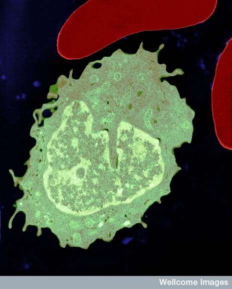 Image au microscope électronique d'un monocyte (blanc) et de deux globules rouges, les couleurs sont artificiellement augmentées. Crédit : University of Edinburgh, Wellcome Images