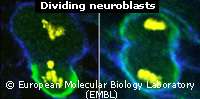 Neuroblastes en division :à gauche division asymétrique normaleà droite perte d'asymétrie conduisant à une prolifération tumorale