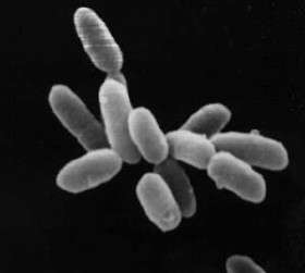 Les archées (ici Halobacterium) sont des organismes unicellulaires phylogénétiquement à mi-chemin entre les eucaryotes et les bactéries. © DR