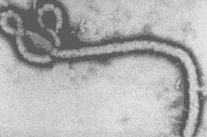 Image en microscopie électronique du virus Ebola (crédit : CDC)