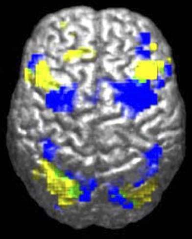 L'autisme est une pathologie liée à des troubles du cerveau. Ce scan révèle que les personnes autistes (en jaune) n'utilisent pas toujours les mêmes régions du cerveau que les personnes exemptes de ce trouble (en bleu) pour réaliser les mêmes tâches. © Ralph-Axel Müller, Wikipédia, cc by 2.5