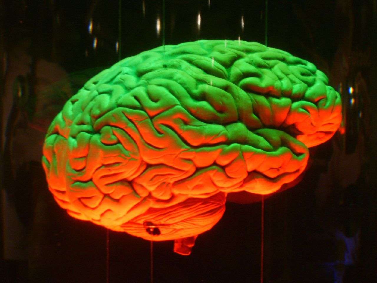 Le Cerveau En Bref En bref : cancer cérébral chez l’enfant, enfin un espoir