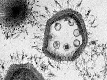 Virophage inclus dans une capside de Mimivirus, observé en microscopie électronique à transmission. © Didier Raoult / CNRS