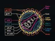 Des tests plus rapides pour dépister le virus HIV Crédits : INSERM 95.STRUCTURE DU VIRUS DU HIV1, RESPONSABLE DU SIDA (CORE = NOYAU; LAYER = COUCHE; KNOB = PROTUBERANCE).
