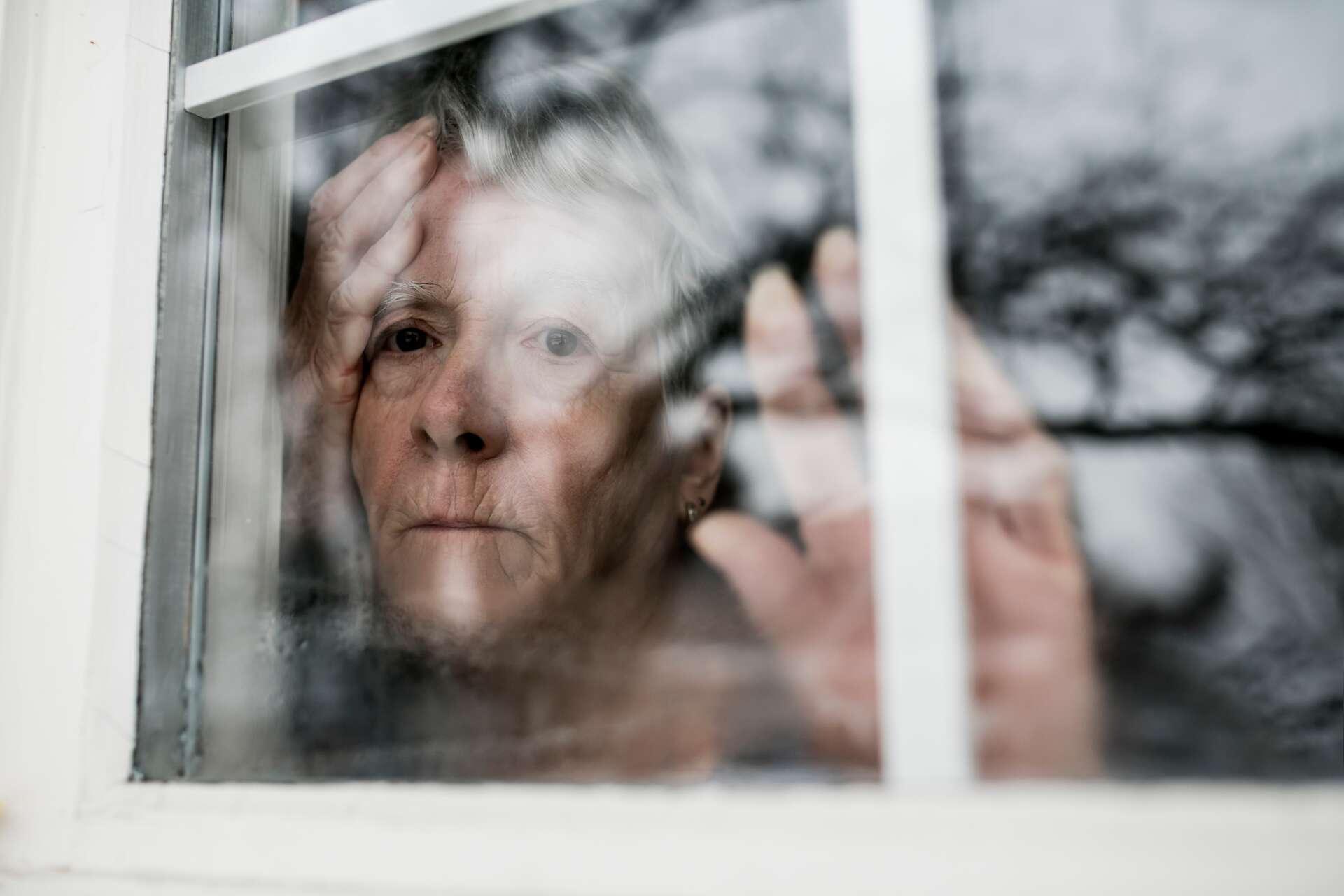 Définition Paralysie supranucléaire progressive Maladie de