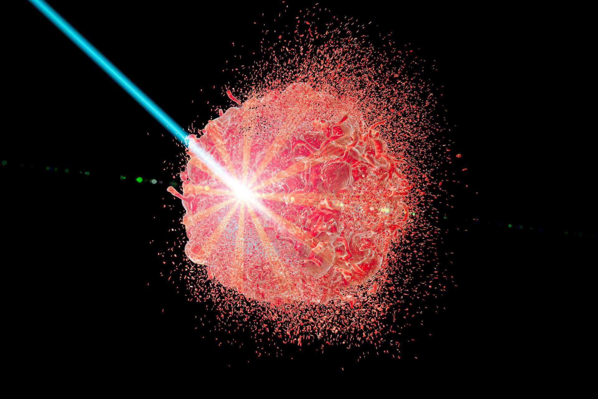 Cancer : une thérapie par la lumière pourrait éliminer 92 % des cellules malades tout en épargnant les tissus sains