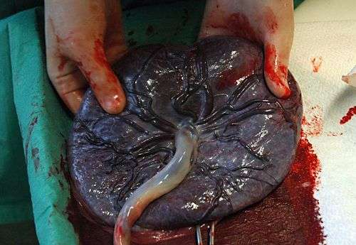 Placenta humain. Crédit : Flickr (auteur Inferis) domaine public.