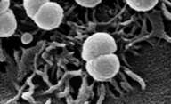 Etats-Unis : Les maladies à méningocoques en augmentation INTERACTIONS MENINGOCOQUES / CELLULES ENDOTHELIALES. ETAPE INITIALE D'ADHESION LOCALISEE. MENINGOCOQUES ADHERANT AUX CELLULES ENDOTHELIALES APRES 4 HEURES D'INFECTION.Crédits : INSERM