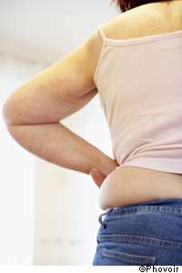 Traiter la cellulite par lipolyse : trop dangereux ! Le surpoids ne pourra plus être traité par lyse adipocytaire. © Phovoir