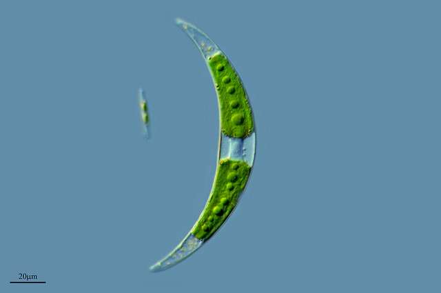 L'algue Closterium moniliferum prend une forme en croissant de lune. © Proyecto Agua/Water project, Flickr, CC by-nc-sa 2.0