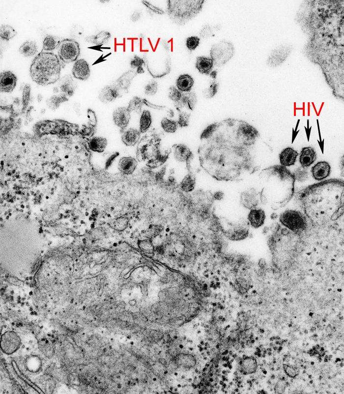 Des rétrovirus vus au microscope électronique à transmission, au milieu de cellules. A gauche, des HTLV-1 (virus T-lymphotropiques humains), à droite des HIV, ou VIH en français, vecteurs du Sida. © CDC