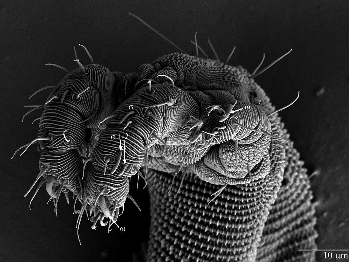 Бактерии на мухе. Морская полихета под микроскопом. Микрофотография дождевого червя. Червяк тихоходка. Тихоходки паразиты.