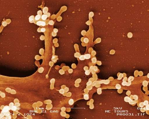 Cellule infectée par le VIH examinée au microscope électronique à balayage. © Philippe Roingeard, Inserm
