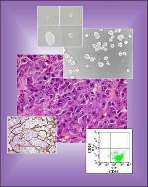 Tissu cancéreux, cellules souches et marqueurs CD24, CD44