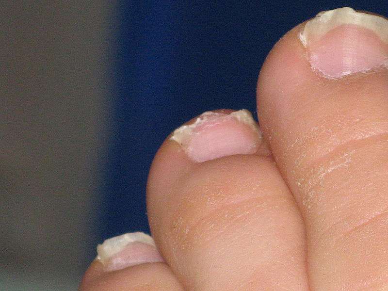Les ongles reposent sur le lit unguéal. © Filip Malkovic, Wikimedia, CC by 2.0