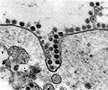 Image en microscopie électronique d'un coronavirus pénétrant dans une cellule.