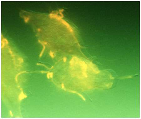 Listeria monocytogenes s'échappant de cellules infectées. © CNRC (Centre national de recherches Canada)