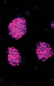 Les cellules souches pluripotentes induites colorées en rose. © Nature methods