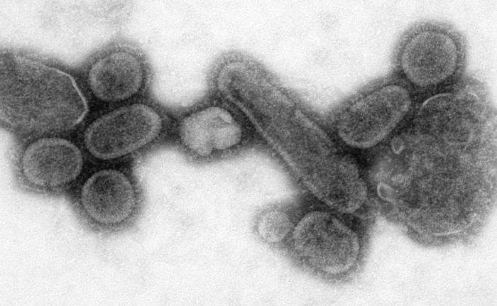 Photographie au microscope électronique du virus de la grippe espagnole rétrospectivement reconstitué par génie génétique à partir d'échantillons de restes humains de 1918. Source : PD-USGov-HHS-CDC