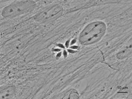Image microscopique d’une cellule humaine infectée par Toxoplasma gondii avec la formation d’une rosette de 8 parasites. Crédit CNRS/Inserm