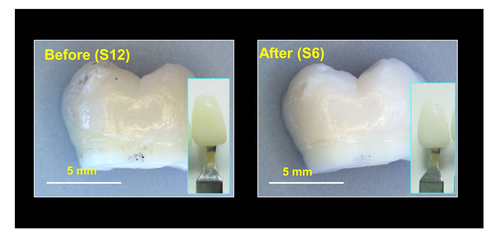 Le gel à base de nanoparticules de dioxyde de titane efface les tâches et rend les dents plus blanches. © ACS Applied Materials & Interfaces, 2021