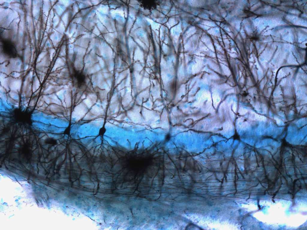 Le transport de l'information nerveuse : des dendrites à l'axone Le transport de l'information nerveuse : des dendrites à l'axone