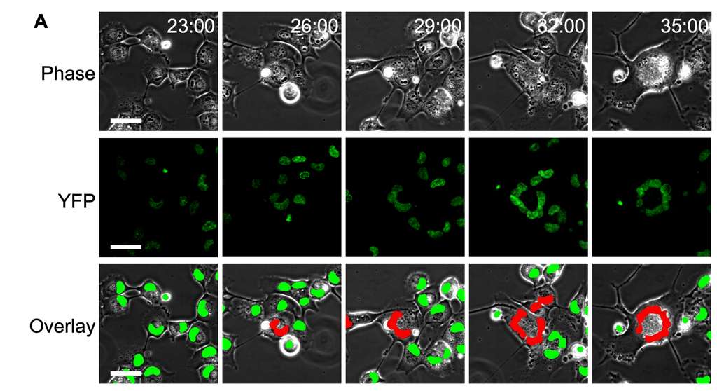  Le time-lapse qui suit la formation d'un syncitium au microscope. Les noyaux des cellules sont en vert, les formes rouges montrent la disposition en anneau caractéristique du syncitium provoqué par le SARS-CoV-2. © Laurelle Jackson et al., BiorXiv