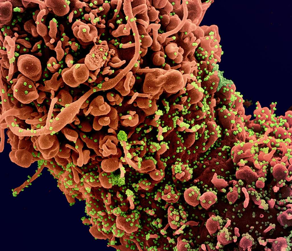 Certaines variantes du virus produisent 270 fois plus de charge virale (en vert) que d’autres. © NIAID