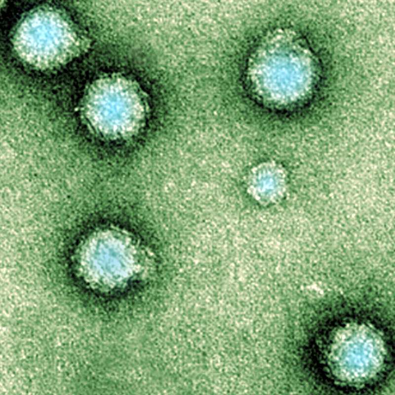 Le virus du Chikungunya, vu au microscope éléctronique. © AJC1, Flickr-CC by-NC 2.0