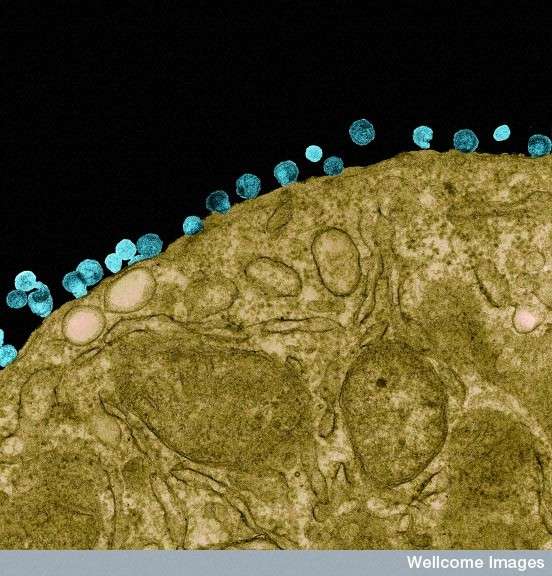 Le VIH (ici en bleu ciel) infeste les lymphocytes T CD4+ et se multiplie en grand nombre. Il sort par bourgeonnement de la cellule de l'immunité avant que celle-ci ne finisse par mourir et que le virus aille infecter d’autres LT4. Parfois, un simple contact avec le virus suffit pour entraîner la mort d’un lymphocyte, ce qui aboutit à la destruction du système immunitaire à terme. © R. Dourmashkin, Wellcome Images, Flickr, cc by nc nd 2.0