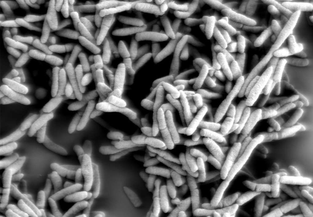 Les bactéries du genre Pseudomonas, grossies ici 5.000 fois, sont aérobies strictes. Mais cette nouvelle bactérie découverte se satisfait très bien de niveaux très faibles en oxygène pour survivre. De quoi coloniser Mars ? © EMSL, Flickr, cc by nc sa 2.0