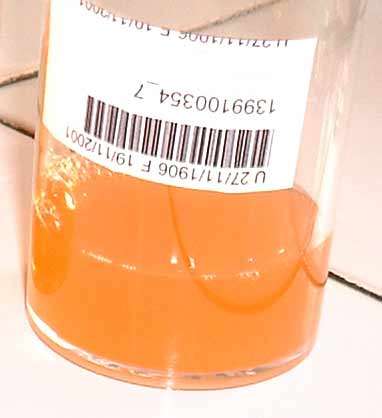 cystite infectieuse symptomes et diagnostic dossier