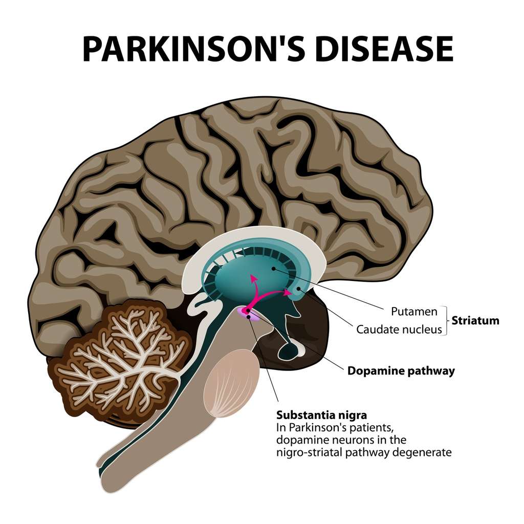 La substance noire (substantia nigra), dont les lésions sont associées à la maladie de Parkinson, se trouve au niveau du tronc cérébral. © designua, Fotolia