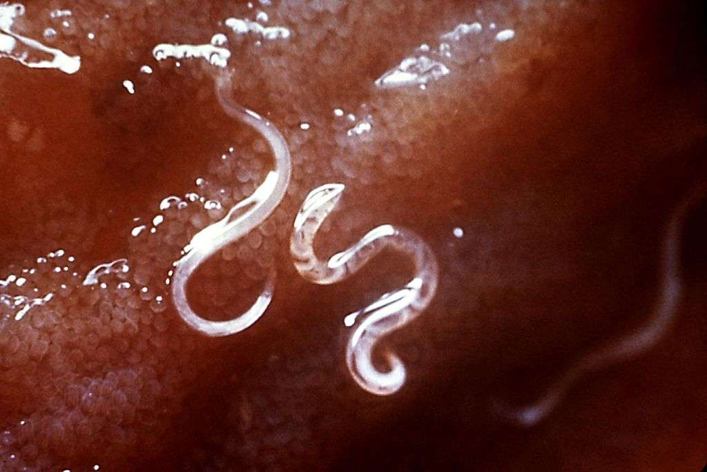 Les ankylostomes constituent l'une des nombreuses espèces de vers pouvant parasiter les intestins humains. © CDC
