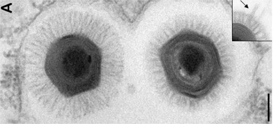 Deux cousins photographiés au microscope électronique à transmission : Mimivirus, à gauche, et Megavirus, à droite. Les deux se trouvent dans la même vacuole d'une amibe. En haut à droite, un épi dans la chevelure de Megavirus. La barre d'échelle noire, en bas à droite, mesure 200 nanomètres (0,2 micron). © IGS, Jean‐Michel Claverie et al./Pnas