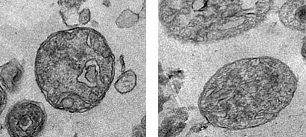 Mitochondries extracellulaires fonctionnelles retrouvées dans le sang. © Alain R. Thierry, Inserm