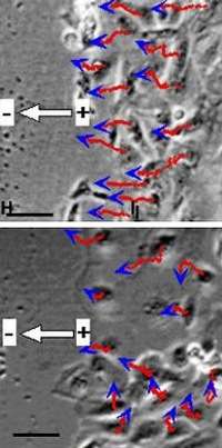 En haut : Dans des conditions normales, les cellules migrent vers le lieu de la plaie En bas : En l'absence du gène p110 gamma, elles errent sans but (Crédits : Bing Song and Min Zhao) En haut : Dans des conditions normales, les cellules migrent vers le lieu de la plaie En bas : En l'absence du gène p110 gamma, elles errent sans but (Crédits : Bing Song and Min Zhao)
