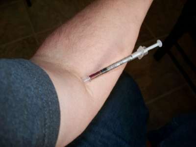 Le VIH peut se transmettre d'une personne à l'autre par l'utilisation d'une seringue usagée et contaminée. Si le risque est infime à l’hôpital, il est bien plus élevé chez les toxicomanes qui partagent parfois les seringues. © CrashTestAddict, Flickr, cc by 2.0