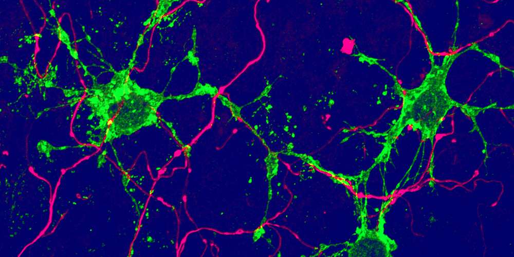 En vert, l'un des types de cellules gliales tout juste découvert dans le cerveau des souris adultes. En rose, les neurones. © Université de Bâle, Biozentrum