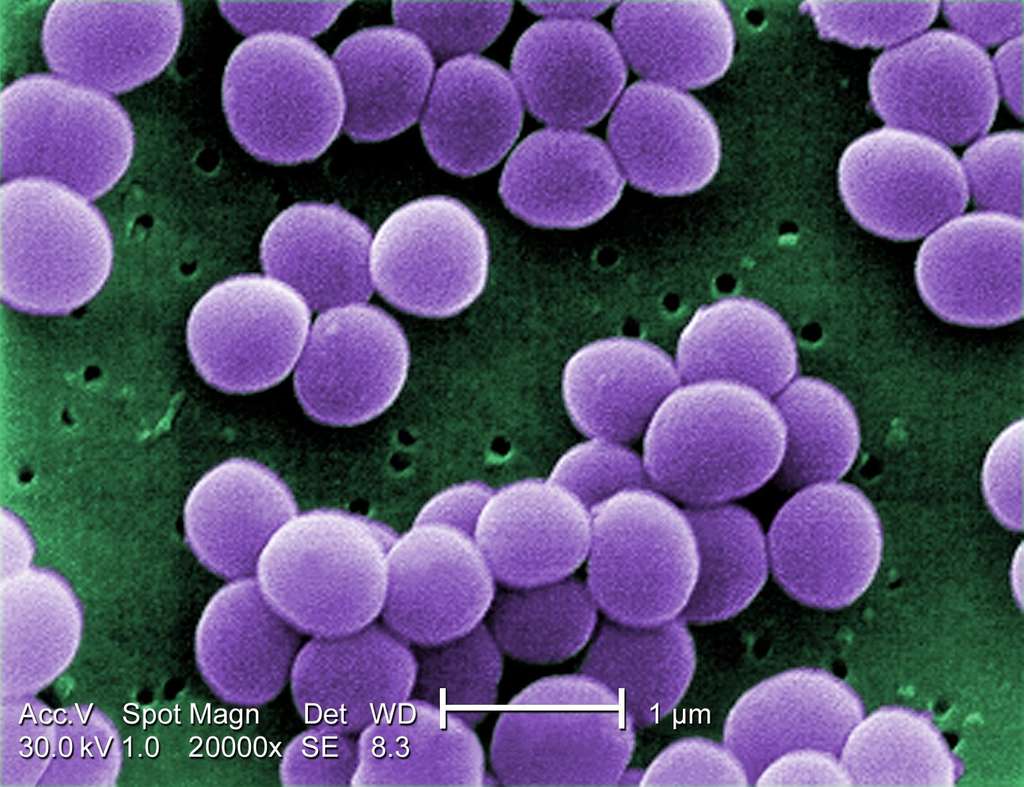 Le staphylocoque doré Staphylococcus aureus, ici vu au microscope électronique à balayage, constitue l'une des menaces de bactéries résistantes les plus importantes, devenant de moins en moins sensible aux antibiotiques. © CDC/Matthew J. Arduino/DRPS, Wikipédia, DP