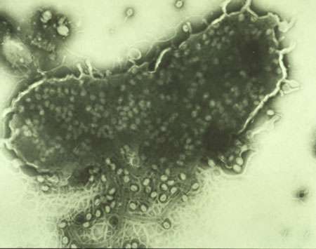 Lyse bactérienne avec phages