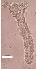 Côlon humain, observation microscopique sous lumière naturelle. © INRA / B. Kaeffe