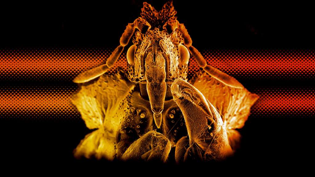 Une redoutable punaise embusquée vue au microscope électronique Une redoutable punaise embusquée vue au microscope électronique