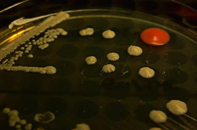 En blanc, des colonies de levures de la souche Saccharomyces cerevisiae cultivées dans une boîte de pétri (le point rouge est un contaminant inconnu). © csaveanu, Flickr, CC by-nc-nd 2.0