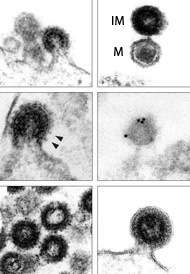 Le virus Phoenix, saisi par le microscope électronique après avoir infecté une cellule humaine. En bas à droite, un virus, en noir, s'apprête à sortir. Crédit : Dewannieux et al., Genome Research