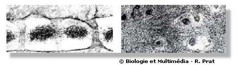 Figures 19 et 20 - Plasmodesmes. Observations en section longitudinale (à gauche) et en section transversale (à droite). Ils constituent de fins canaux formés par la membrane plasmique et mettent ainsi en communication les cytoplasmes de deux cellules voisines. Ils contiennent à l'intérieur un tractus en rapport avec le réticulum endoplasmique.